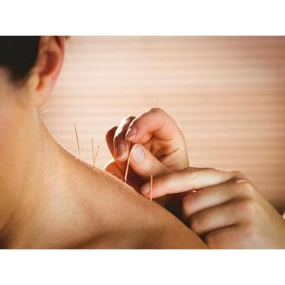 Acupuncture & Chinese Medicine treatment
