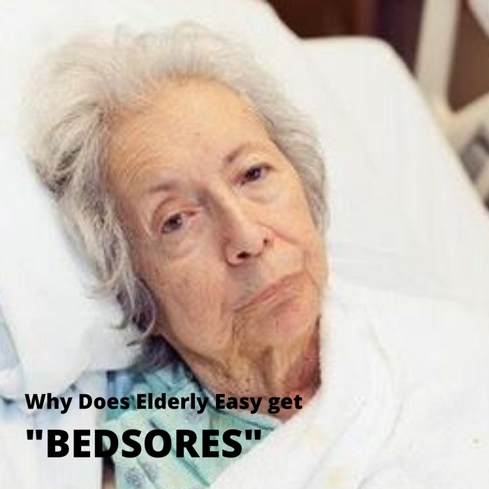Why Does Elderly Easy get "BEDSORES"