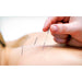 Acupuncture and Chinese Medicine Treatment (Home Treatment) - Asian Integrated Medical Sdn Bhd (ielder.asia)