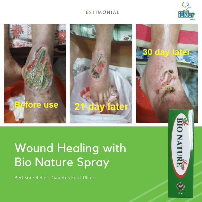 [Wound Healing] Bio Nature Spray (10ml) (Expiry date: July 2024)