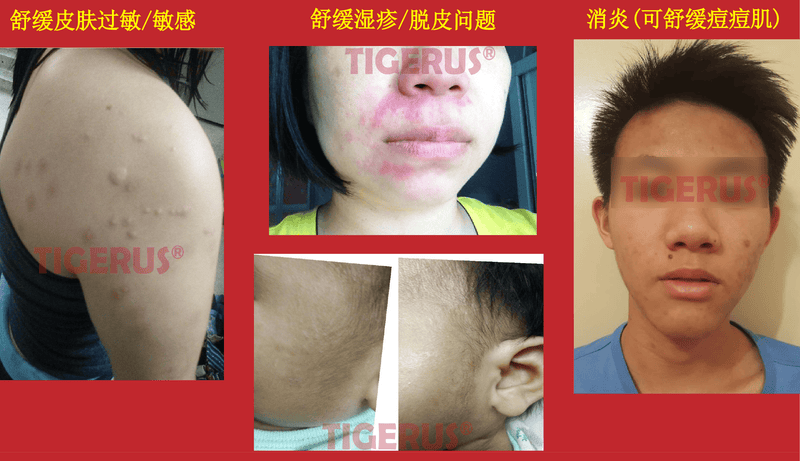 TIGERUS Tiger Milk Mushroom Soap (20mg) - Asian Integrated Medical Sdn Bhd (ielder.asia)